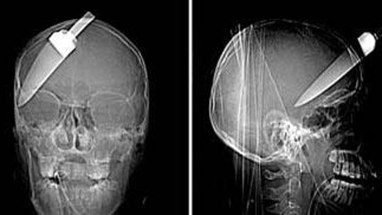 Britanska policija je razkrila neverjetne rentgenske posnetke.