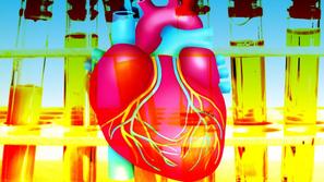 Hiperholesterolemija