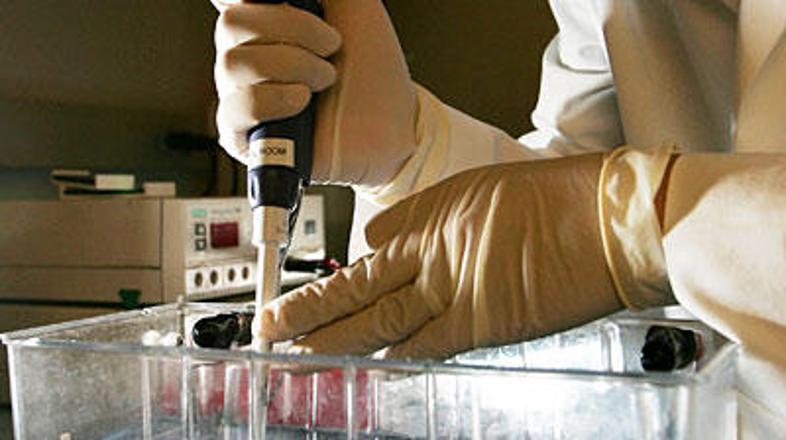 V Veliki Britaniji podrobno preučujejo raka dojk. (Foto: AFP)