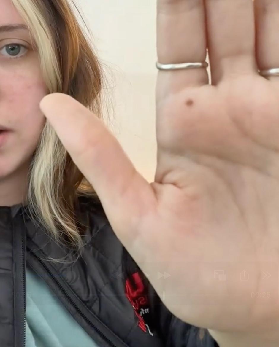 Znamenje na dlani | Avtor: Profimedia