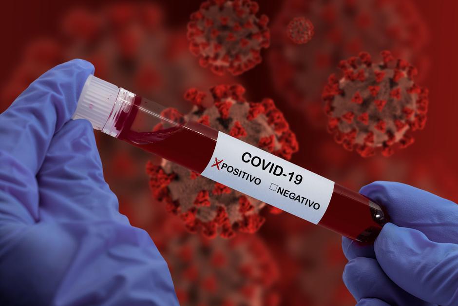 Novi koronavirus | Avtor: Profimedia