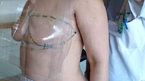 Na fakulteti za strojništvo lahko izdelajo kalup tudi v 24 urah. Cena rekonstruk