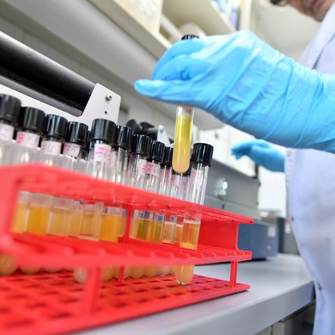 doping epruveta