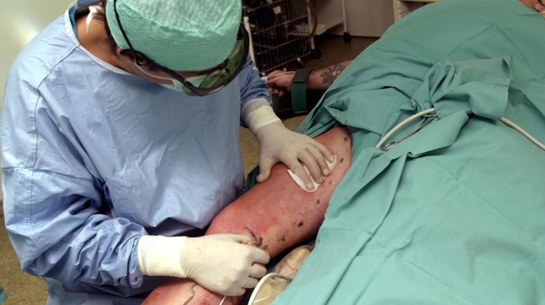 Operacija krčnih žil