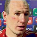 Arjen Robben 