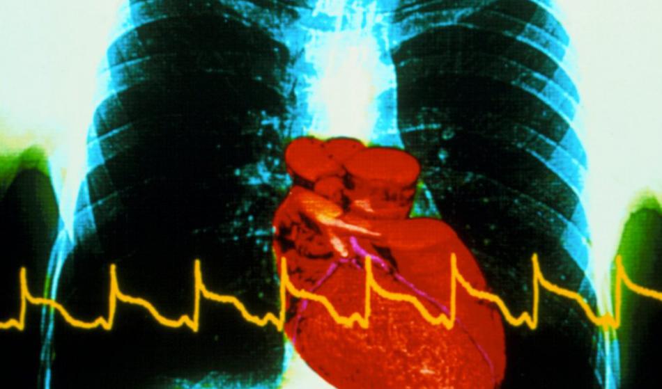 Večina srčnih infarktov naj bi bilo povezanih s to običajno jutranjo navado