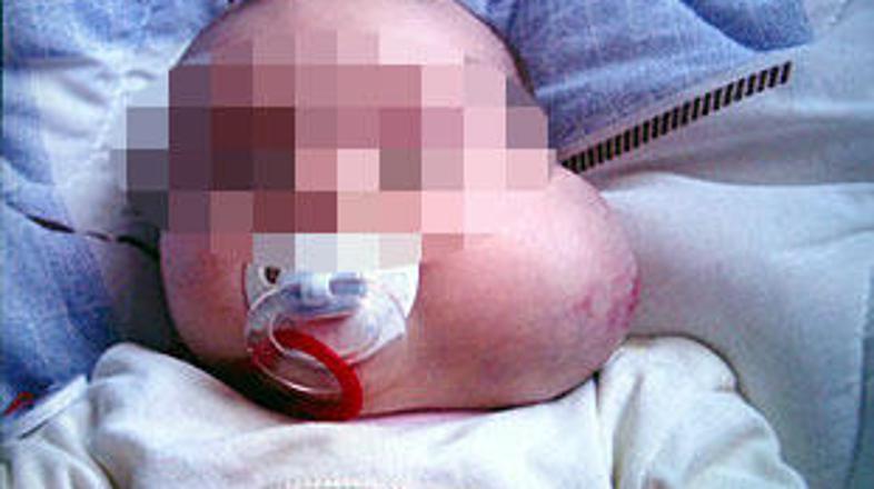 Sporno cepivo, ki je prišlo kot donacija Visokega komisariata za begunce, se je 