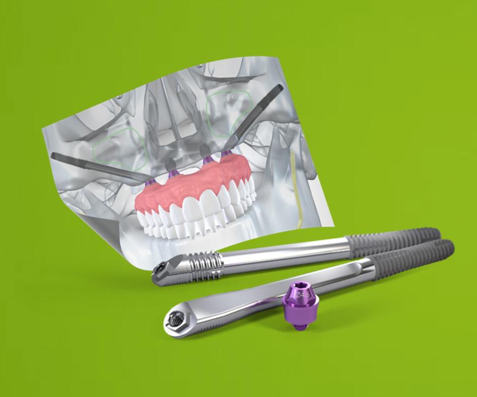 zygoma, zobje | Avtor: Dentalna poliklinika Dr. Gikić