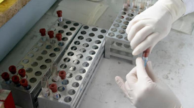 Laboratorij HIV AIDS epruvete iStock