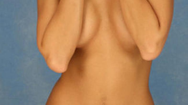 Raziskava kaže, da večina žensk ni dovolj motivirana, da bi se pregledovala redn