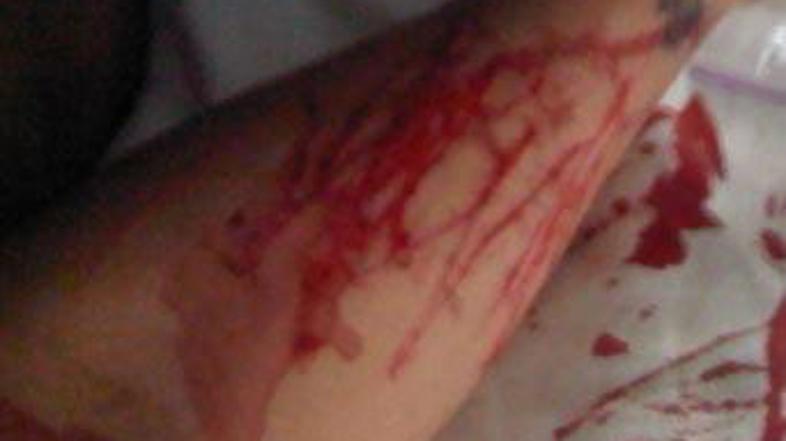 Fotografija, ki je prestrašila oboževalce.