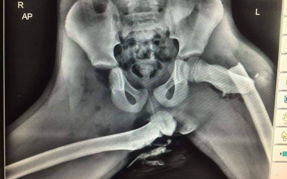 Rentgenski posnetek noge na armaturki | Avtor: Reševalni pas/Twitter