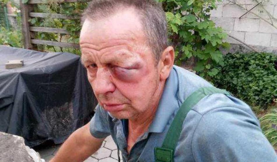 Ko je ugotavljal, koliko krompirja so mu ukradli, so ga brutalno pretepli Romi