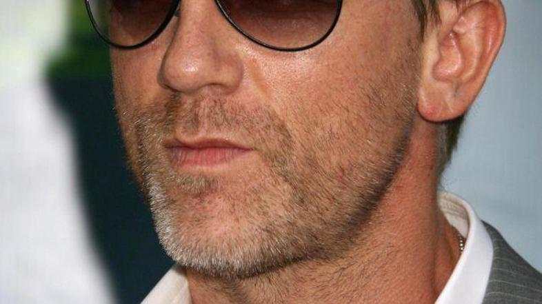 Nevarno snemanje je pustilo posledice.