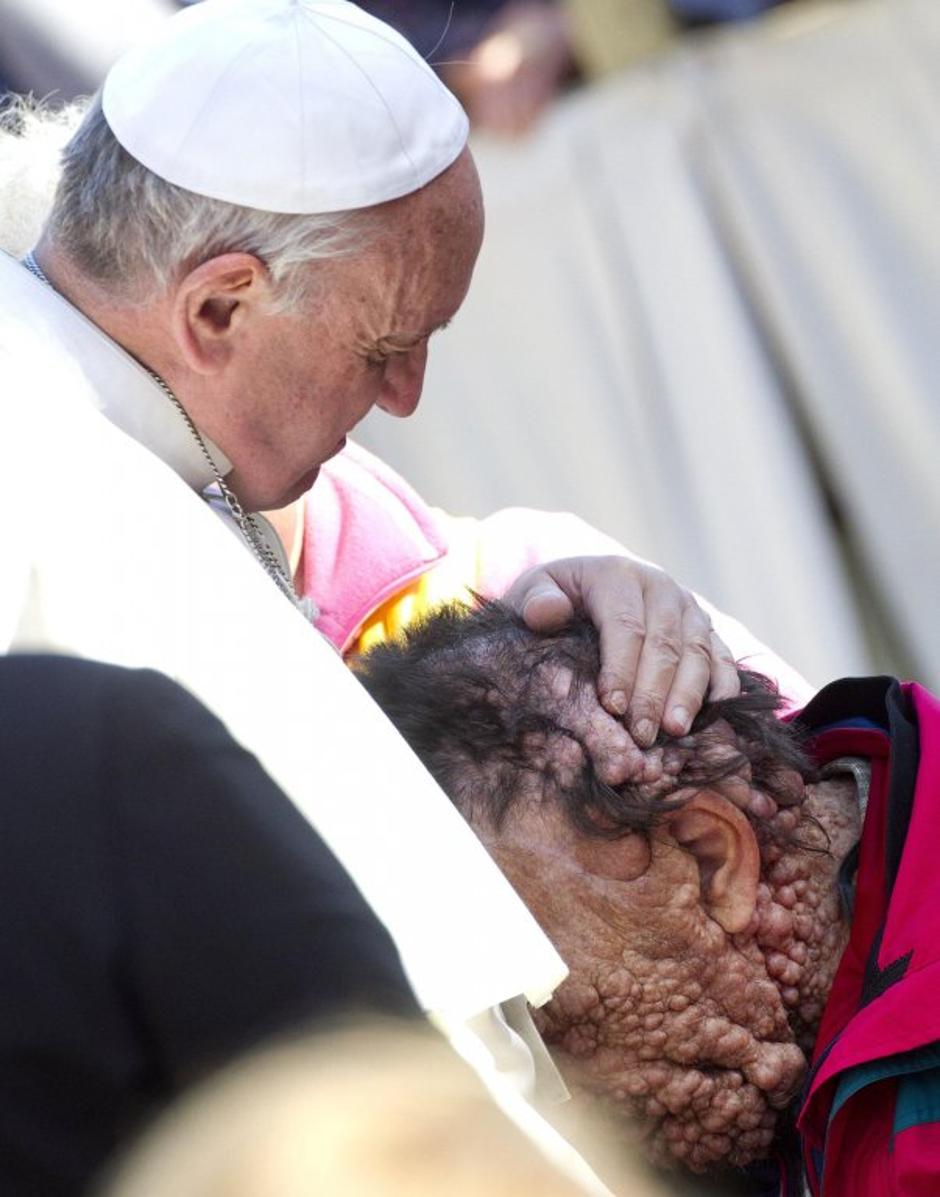 Papež poljubiol bolnika | Avtor: EPA