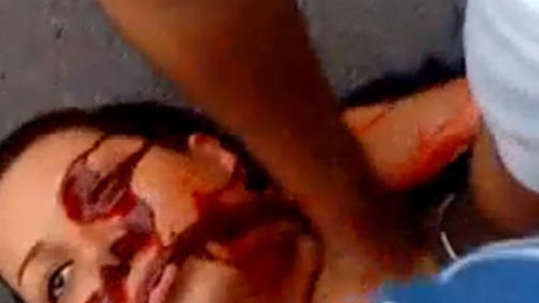 Neda, ena izmed uradno priznanih žrtev protestov po volitvah, je postala simbol 