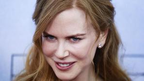 Igralka je po več letih zanikanja le priznala, da njen obraz ni naraven. (Foto: 