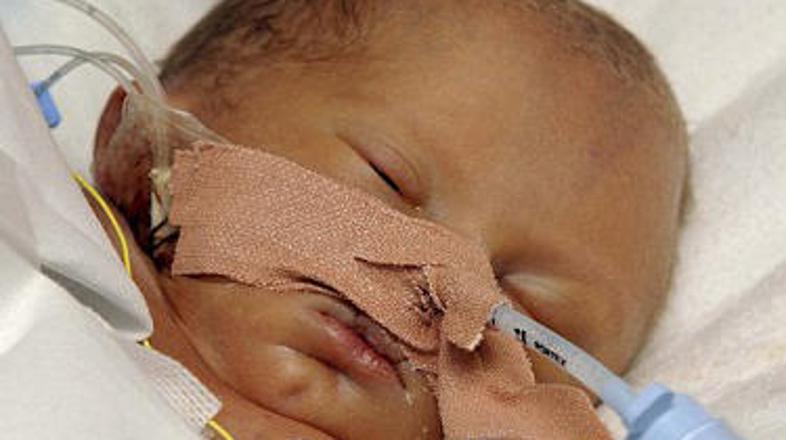 Faith je preživela še eno operacijo.