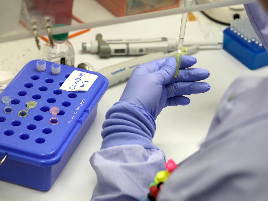 koronavirus | Avtor: Profimedia