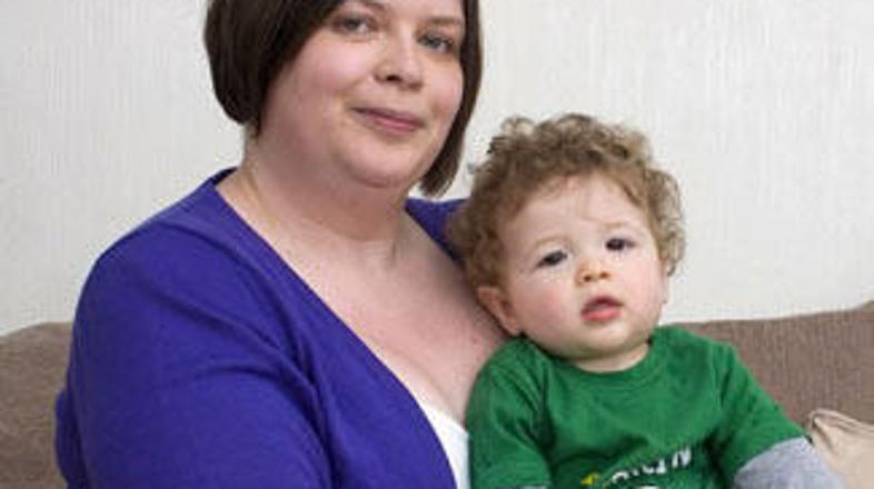 Joanne je zbolela za redko vrsto alergije.