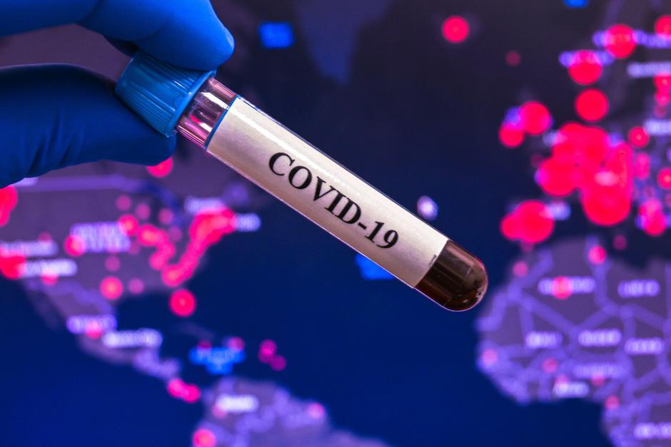 Covid-19 | Avtor: Profimedia