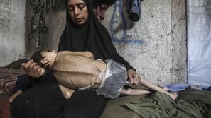 Gaza, izstradani otroci