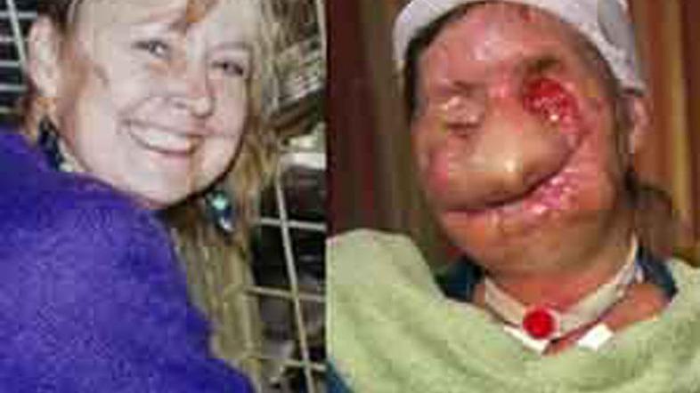 Carla pred in po napadu. (Foto: Daily Mail)