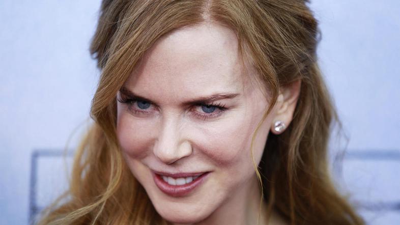 Igralka je po več letih zanikanja le priznala, da njen obraz ni naraven. (Foto: 