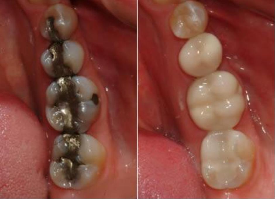 3ddent | Avtor: 3ddent