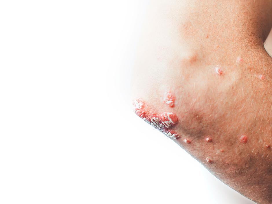  | Avtor: Spletno nakupovanje