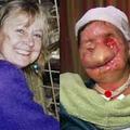Carla pred in po napadu. (Foto: Daily Mail)