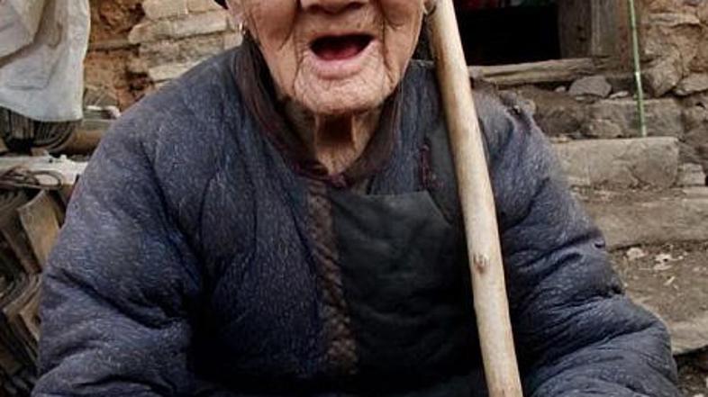 Družina je zaskrbljena zaradi nenavadnega izrastka. 