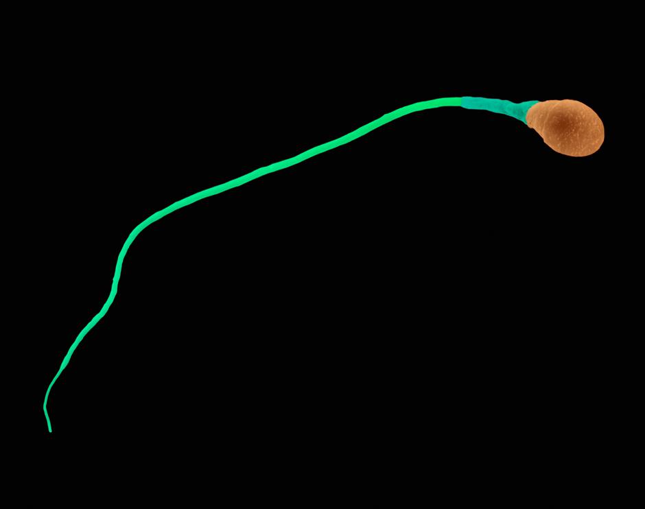 Semenčica sperma | Avtor: Profimedia