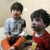 Sirija otroci bombni napad
