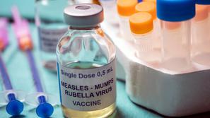 Cepivo proti ošpicam in mumpsu