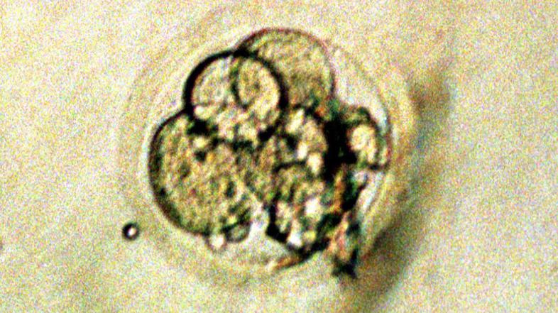 Nastajanje človeškega embria.