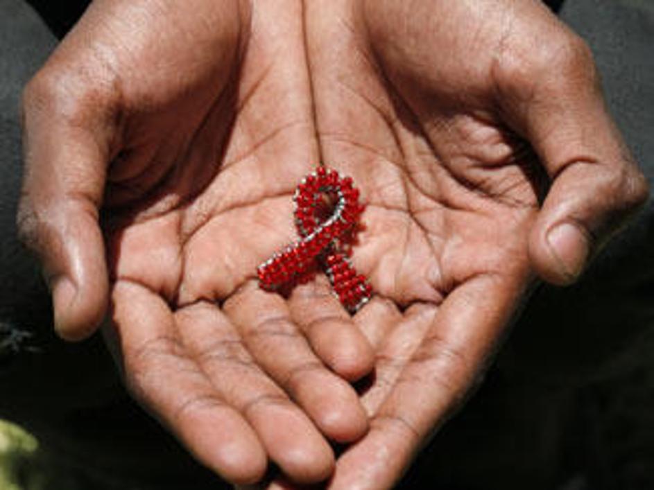 Od leta 1981 pa do danes je zaradi aidsa umrlo več kot 25 milijonov ljudi po vse
