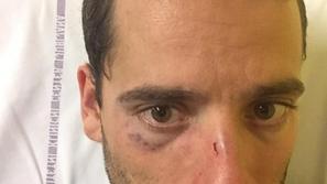 Posledice napada na Golovcu