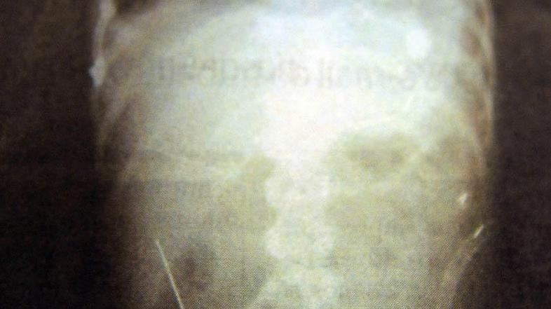 Vseh igel ne bodo mogli odstraniti. (Foto: AFP)