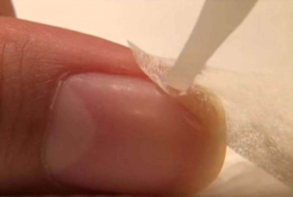 Popravljanje nohta | Avtor: Youtube