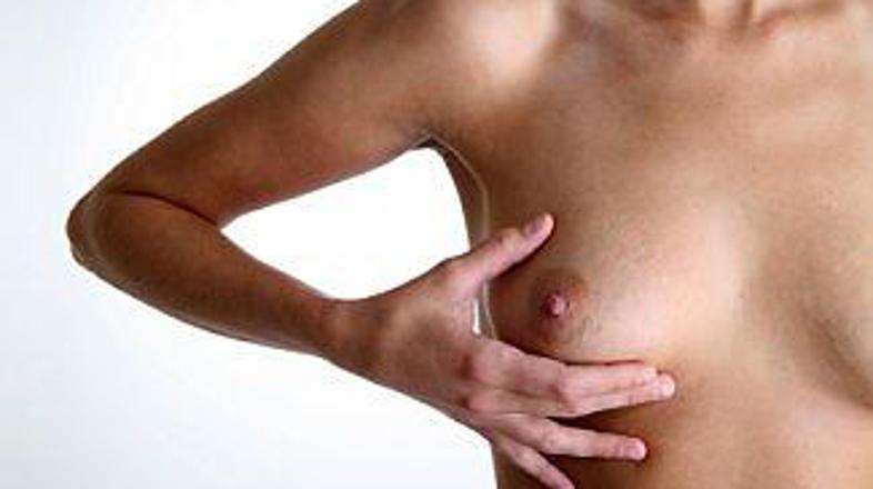 Nekatere rase so bolj ogrožene.