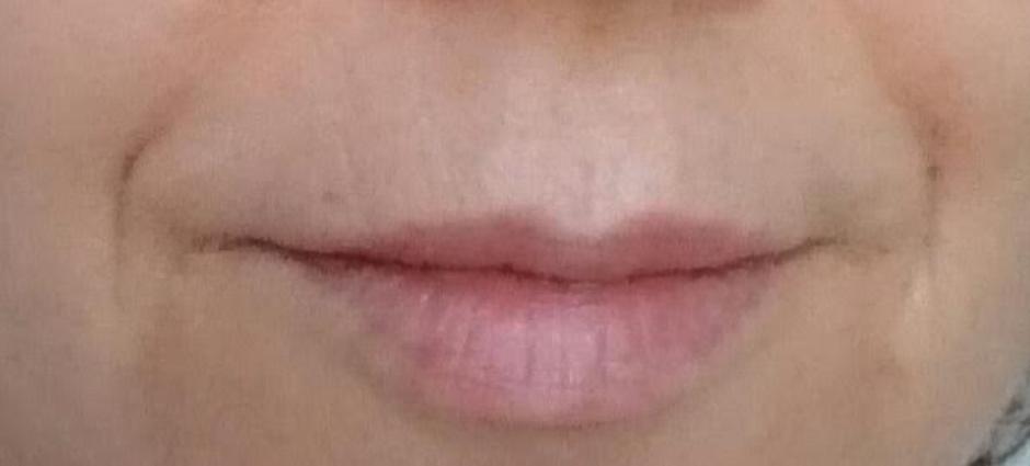 lice | Avtor: Zurnal24 foto