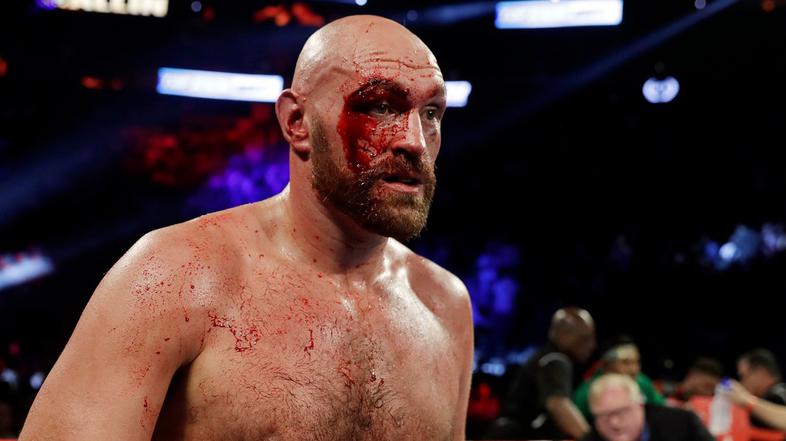 Tyson Fury