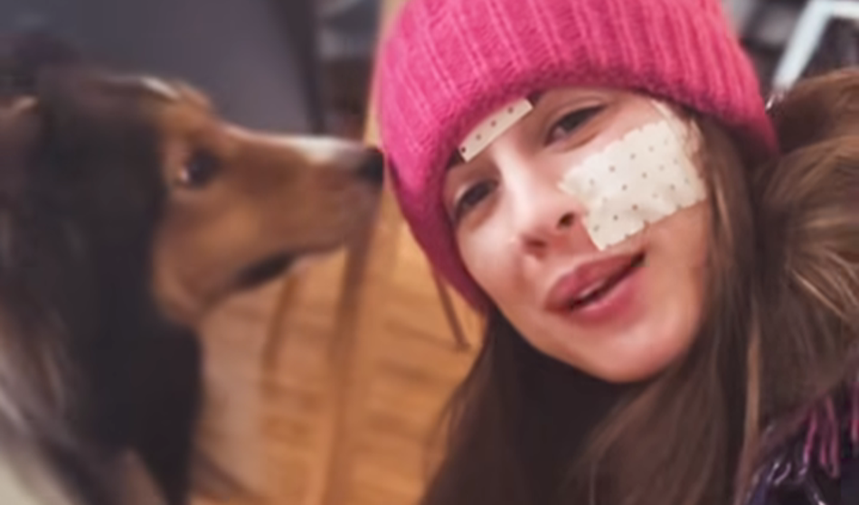 Prekrita z obliži: Kaj se dogaja z lepim obrazom Tare Zupančič?