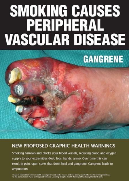 Ovitki zavojčkov cigaret