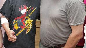 Draganu Buliču (desno igralec Jos Zalokar) so zaradi lipoma na desni podlakti v 