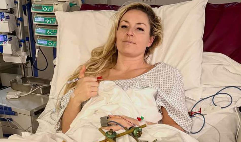 Toliko operacij vsaj še čaka Lindsey Vonn