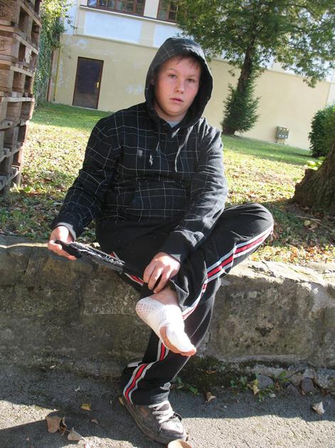 Trinajstletni Denis Čajko je bil danes že doma, z opečeno nogo in poškodbami na 