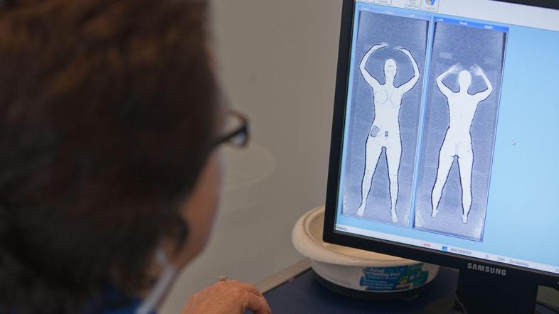 Skenerji naj bi pomagali pri iskanju teroristov, a po mnenju mnogih globoko pose