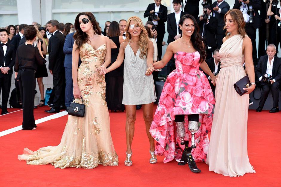 Giusy Versace | Avtor: Profimedia